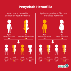penyebab hemofilia