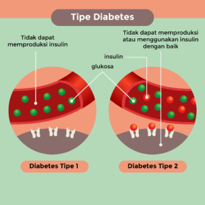 tipe diabetes
